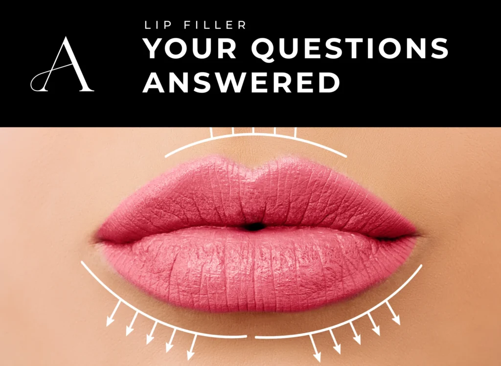 How Long Does Lip Filler Last? Everything You Need to Know